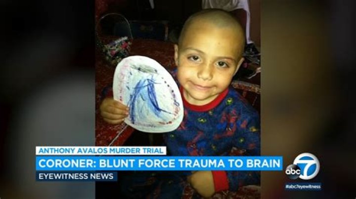 Anthony Avalos death Coroner testifies that 10yearold's brain showed