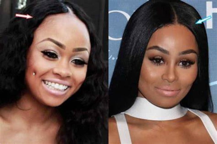 Blac Chyna Plastic Surgery EXPOSED? (Before & After Photos 2018)