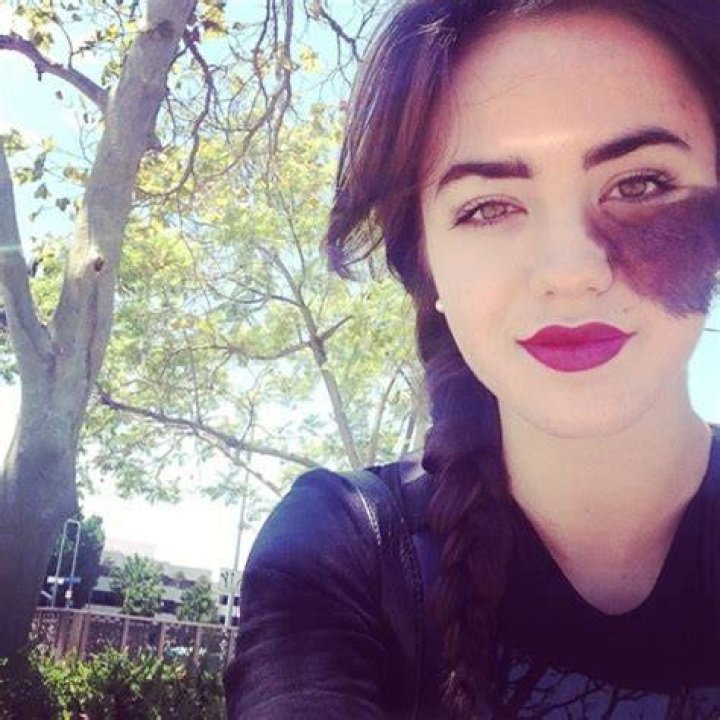 Dancer Cassandra Naud with Birthmark on Face Embraces Her Beauty