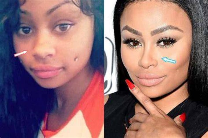 Did Black Chyna Have Plastic Surgery? (Before & After 2021)