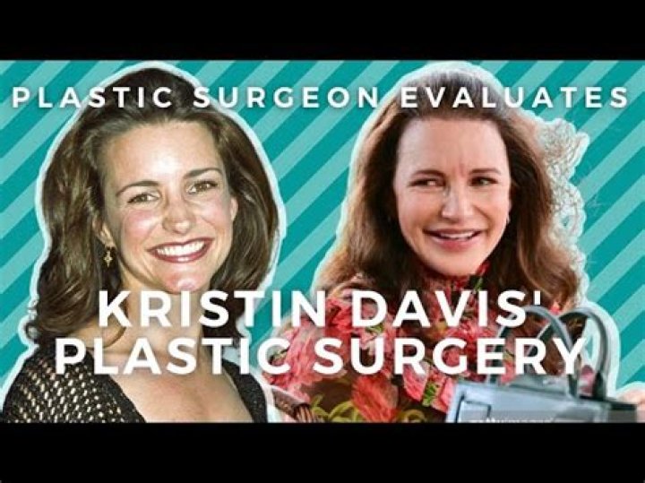 Did Kristin Davis Undergo Plastic Surgery? Fans Speculate