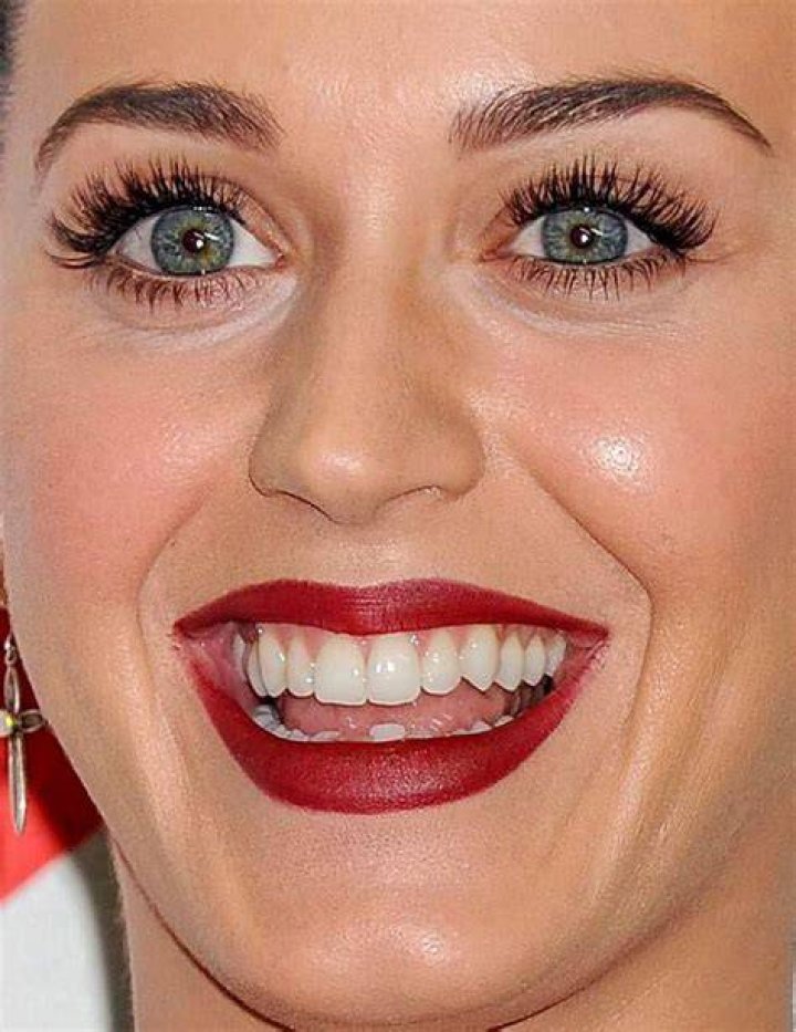 Katy Perry White Teeth