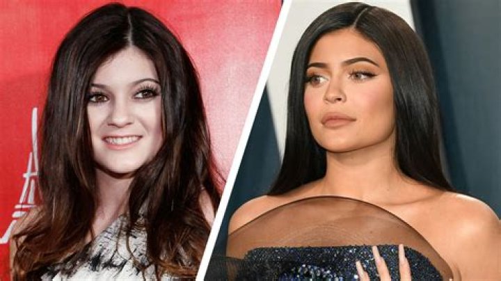 Kylie Jenner, Before and After Transformation