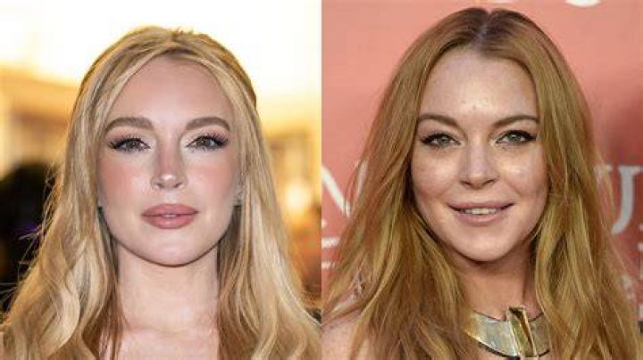 Lindsay Lohan Before and After Plastic Surgery