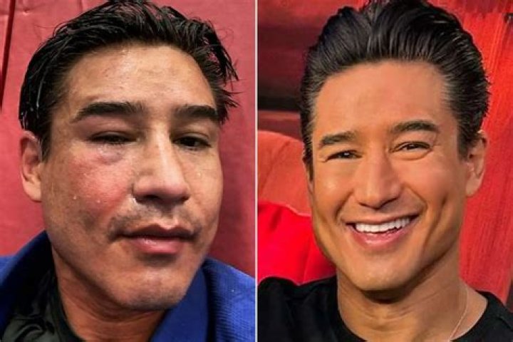 Mario Lopez Today / 46 Celebrities Then Vs Now Celebrities Then And Now