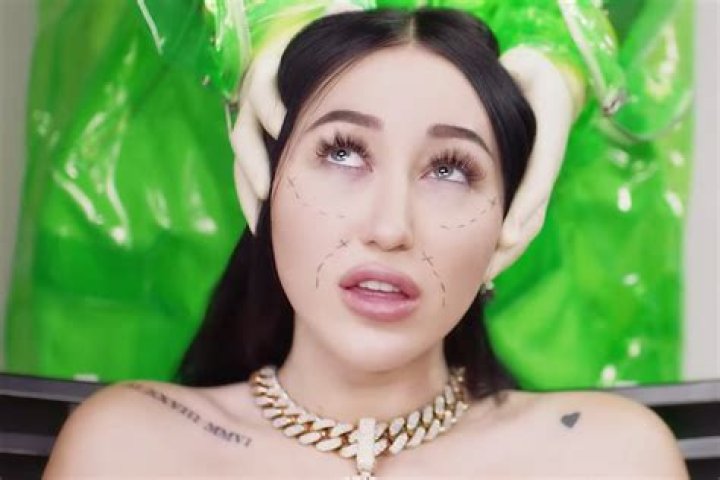 Noah Cyrus Goes Under the Knife in Gory &lsquo;FckYouNoah&rsquo; Video Rolling Stone