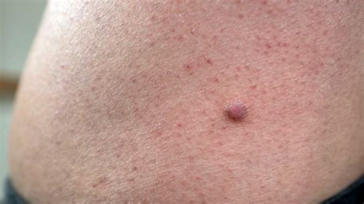 Pin on m&aring;neskin