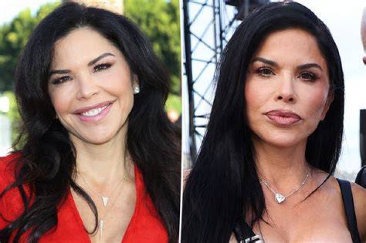 Plastic surgery experts on what Lauren S&aacute;nchez may have had done