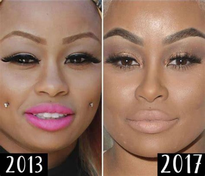 Plastic Surgery? See Blac Chyna's Body Change Over Time