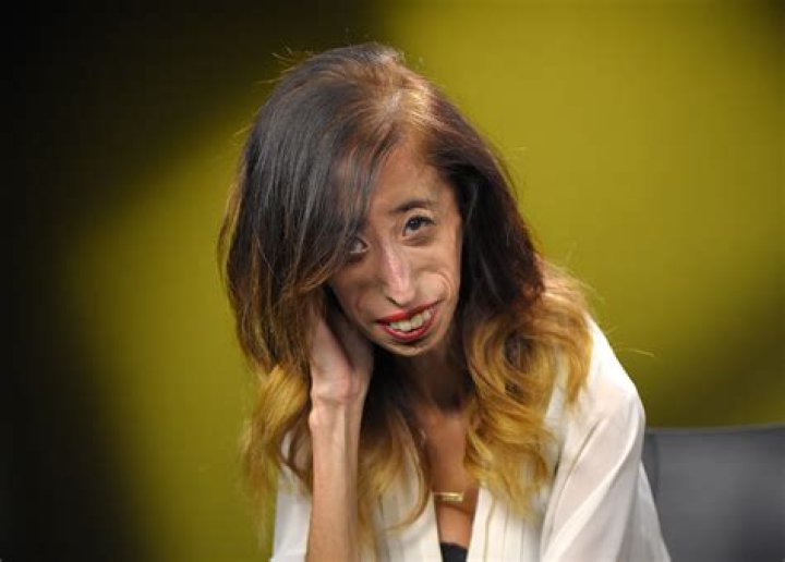 She Was Named World&rsquo;s Ugliest Dog, but &lsquo;She&rsquo;s Just Darling&rsquo; The New