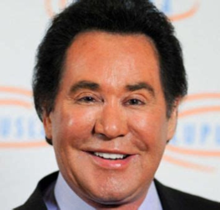 Wayne Newton Plastic Surgery A Las Vegas Facelift