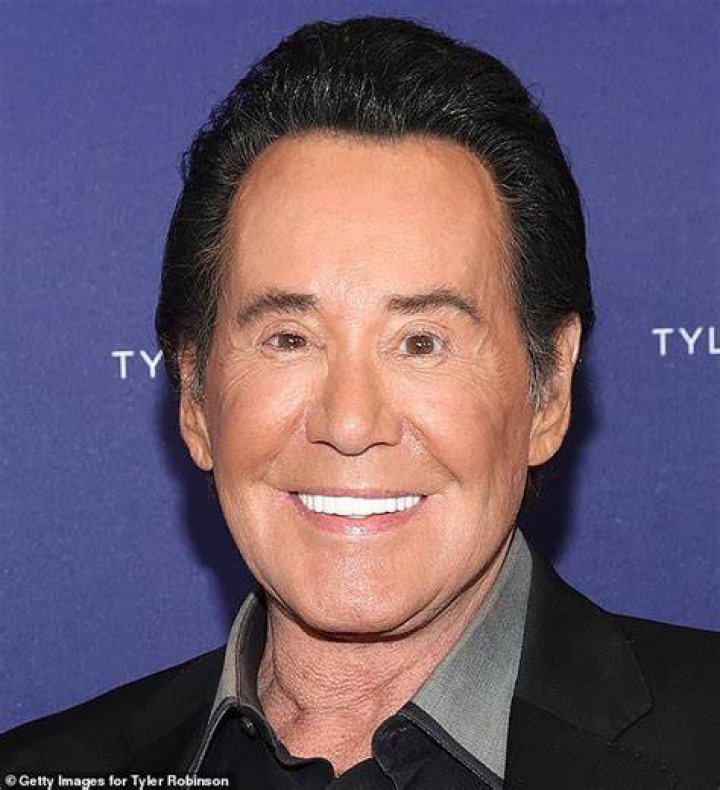 Wayne Newton Plastic Surgery Facelift, Botox, Eyelid Surgery