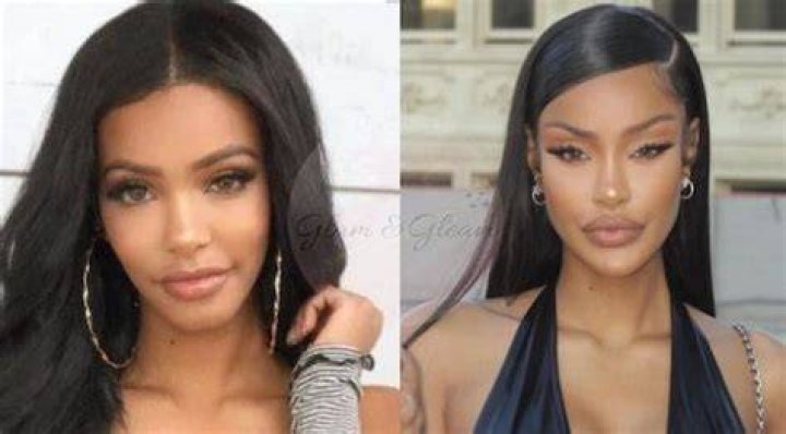 Yodit Yemane Plastic Surgery Before And After Pics, Age And Boyfriend
